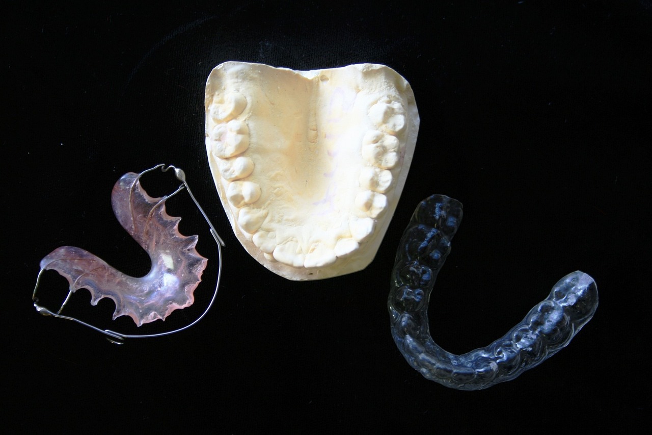 İnvisalign Tedavisinde İşte Dişlerinizin Daha Hızlı Hareket Etmesini Sağlayacak 5 Öneri