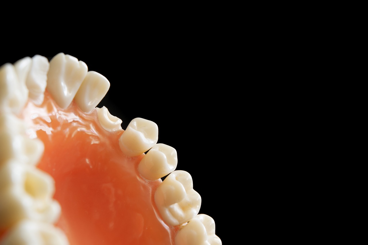 Invisalign Tedavisi Sonrası Dişlerinizi Düzgün Pozisyonda Tutmak İçin Yapmanız Gerekenler