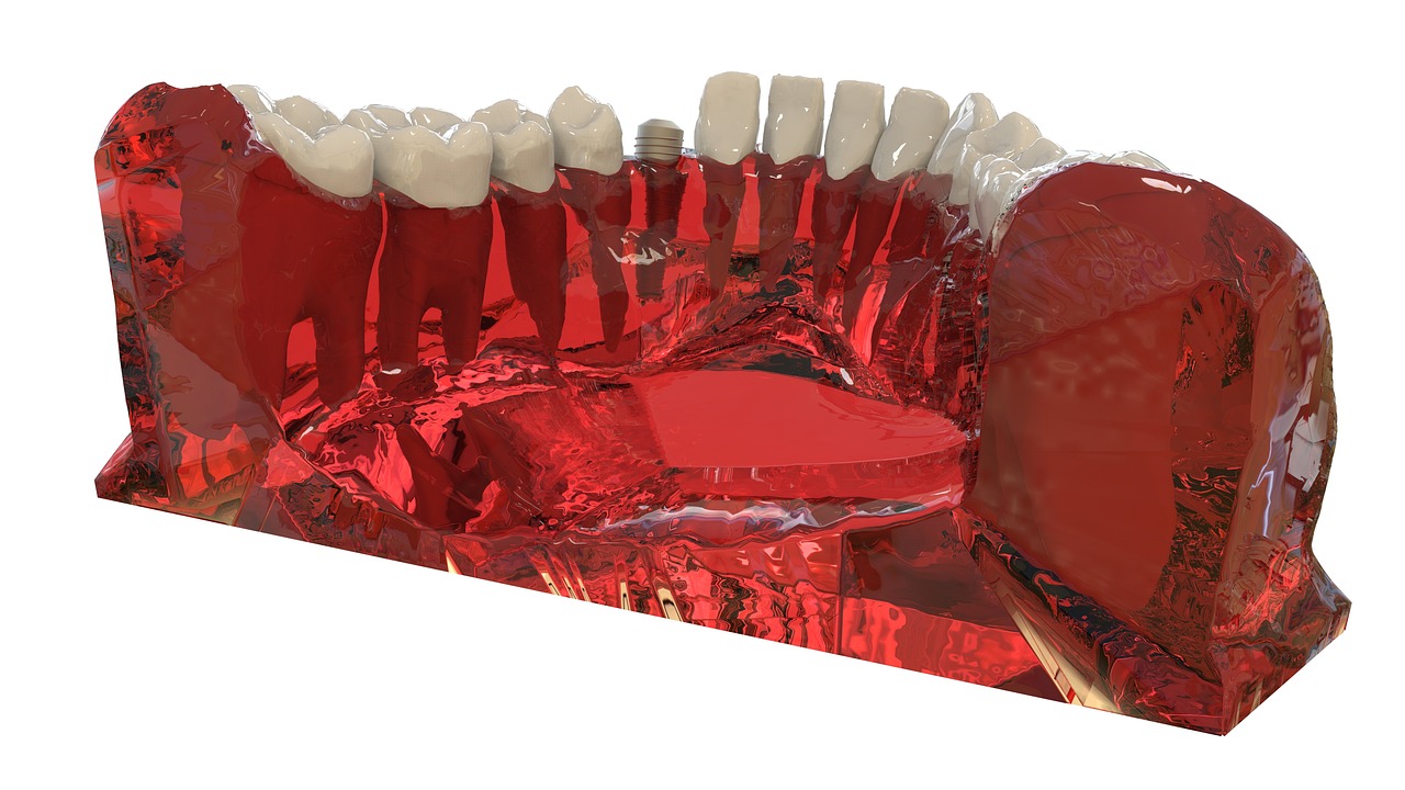 Diş Teli veya Invisalign: Hangisi Daha İyi?