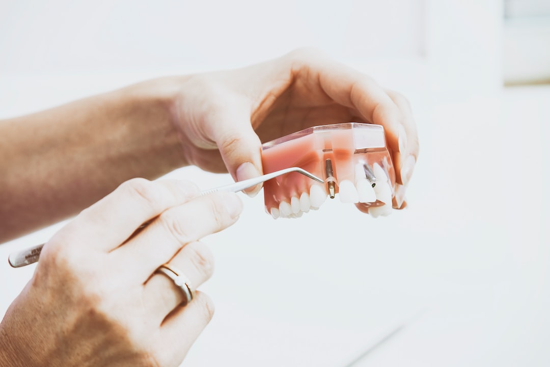 Invisalign Tedavisiyle Elde Edilen Sonuçları Paylaşan Hasta Hikayeleri