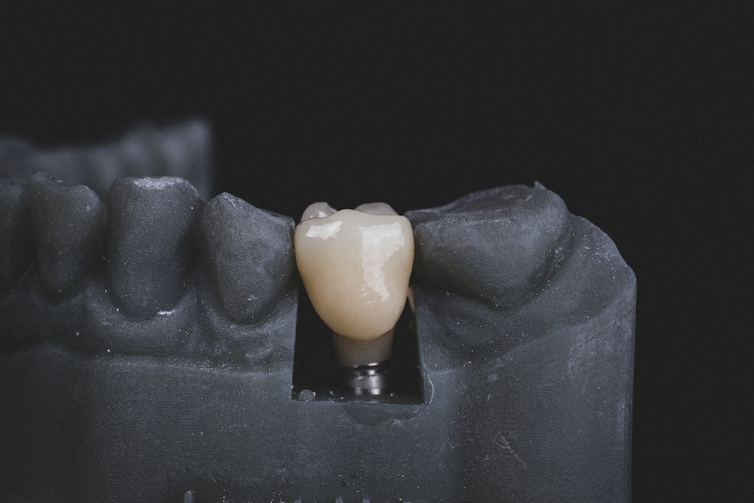 İnvisalign Tedavisinde Plaklarınızı Temizlemenin 5 Kolay Yolu