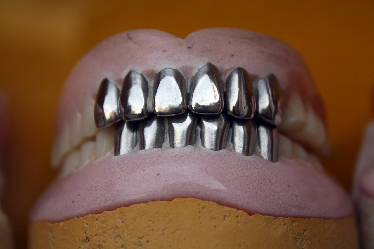 Invisalign Tedavisiyle Elde Edilen Sonuçları Paylaşan Hasta Hikayeleri