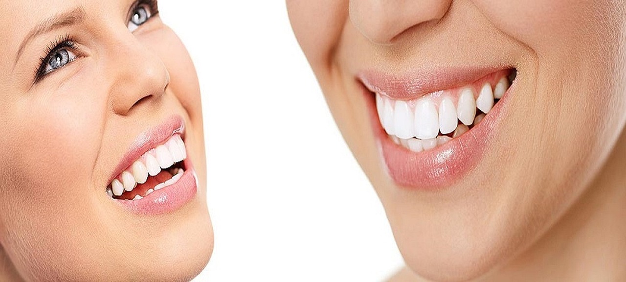 İnvisalign Tedavisi ve Nane Şekeri: Dişlere Zarar Verir mi?