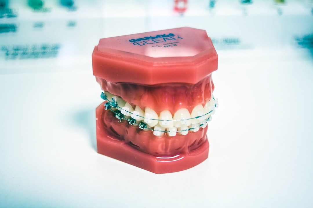 İnvisalign ile Şeffaf Plaklar