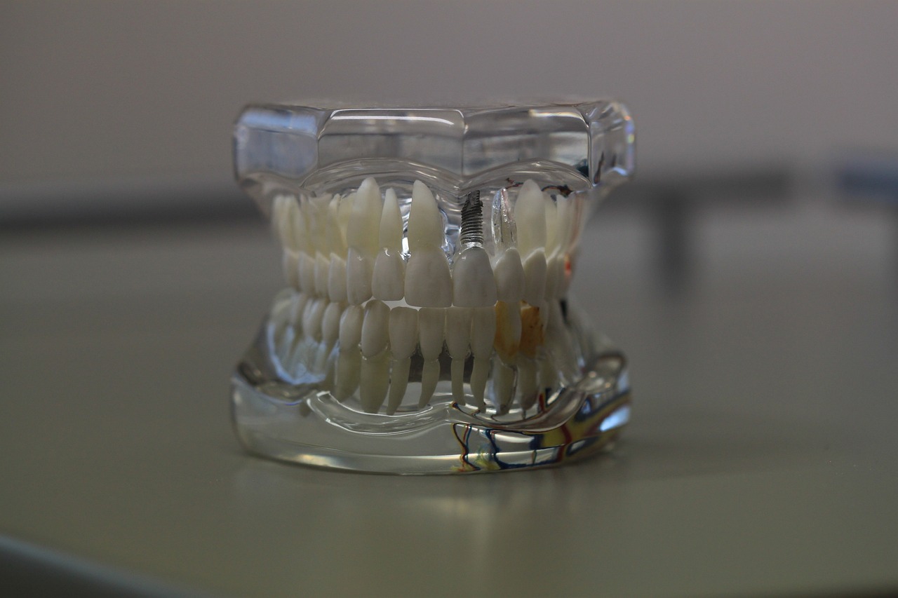 İnvisalign Plaklarınızı Temizleme Sırasında Ağzınızı Durulama İpuçları