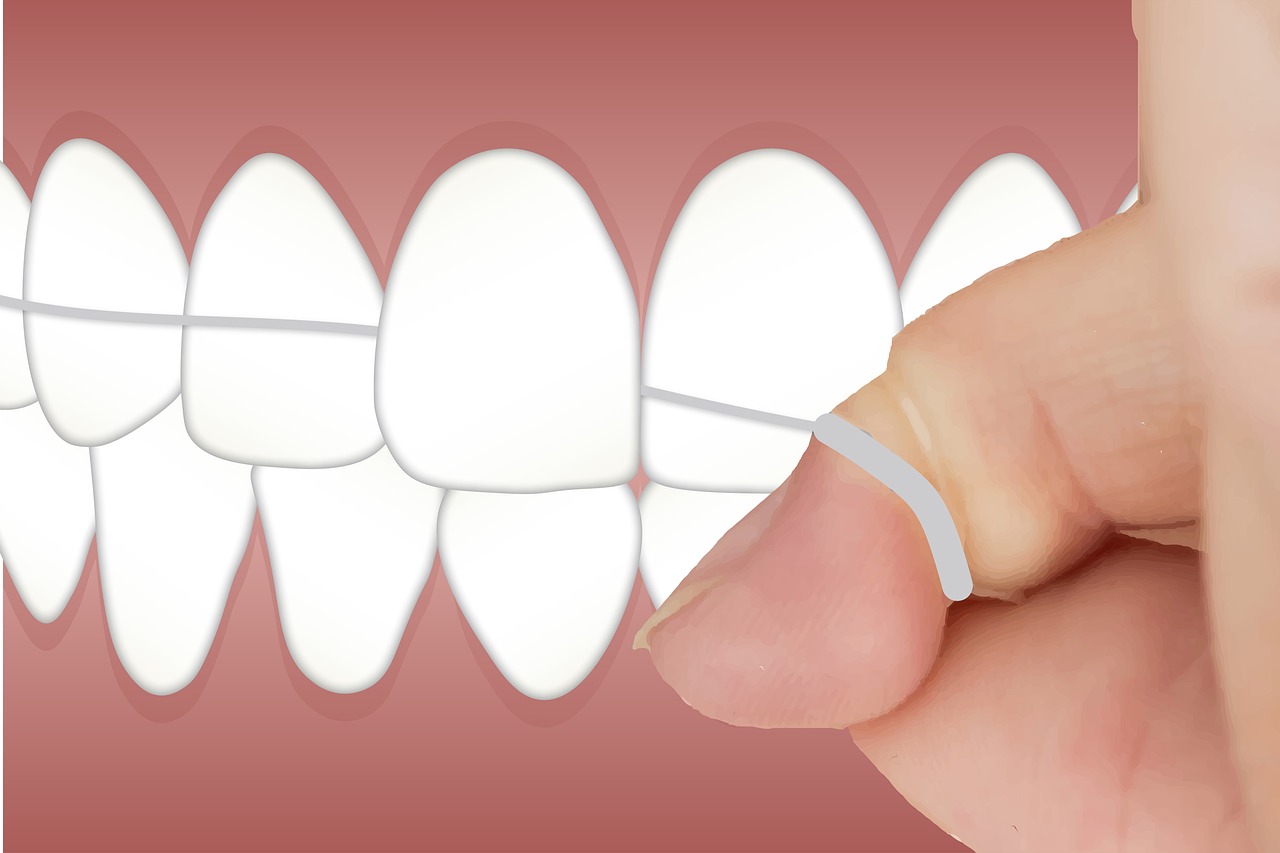 Invisalign Tedavisinde Diş Fırçalama ve Diş İpi Kullanımının Ortodontik Sonuçlara Etkisi