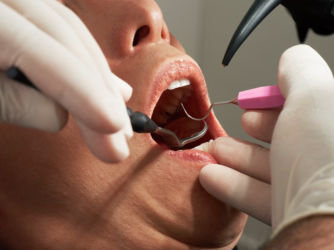 İnvisalign Nedir?